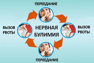 Лечение булимии в Губахе